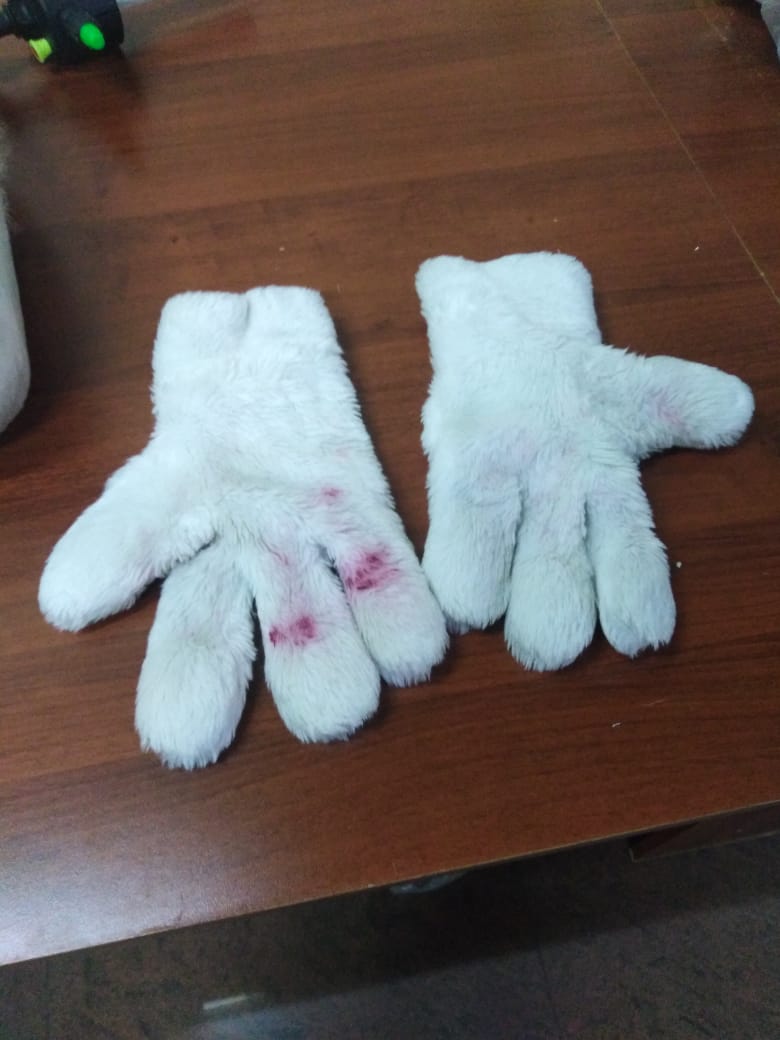 Любые повреждения